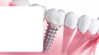 EXL Dentists | Best Dentist/Dental Clinic in DLF Phase 4 Gurgaon