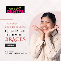 Mint Leaf Dental Aligners, Implants, Extraction, RCT, Crowns & Braces Clinic In Sector 52 Gurgaon