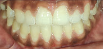Smile + Dental Clinic - Dr. Monika(Gold Medalist)