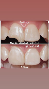 AHUJA DENTAL CLINIC SINCE 1951