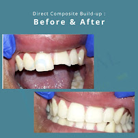 The Dental Elegance and cosmetology centre | Dentist | Dr. Aashu Thakran