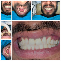 Dental Krafts - Best Ex AIIMS Dentist, Dental Clinic Near Me, Sector 57 Gurgaon