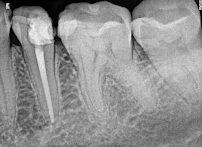 Roots and Grins Dental clinic in Indiranagar, Bangalore