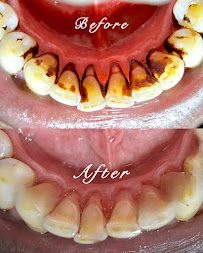 DENTAL 360 | INDIRANAGAR
