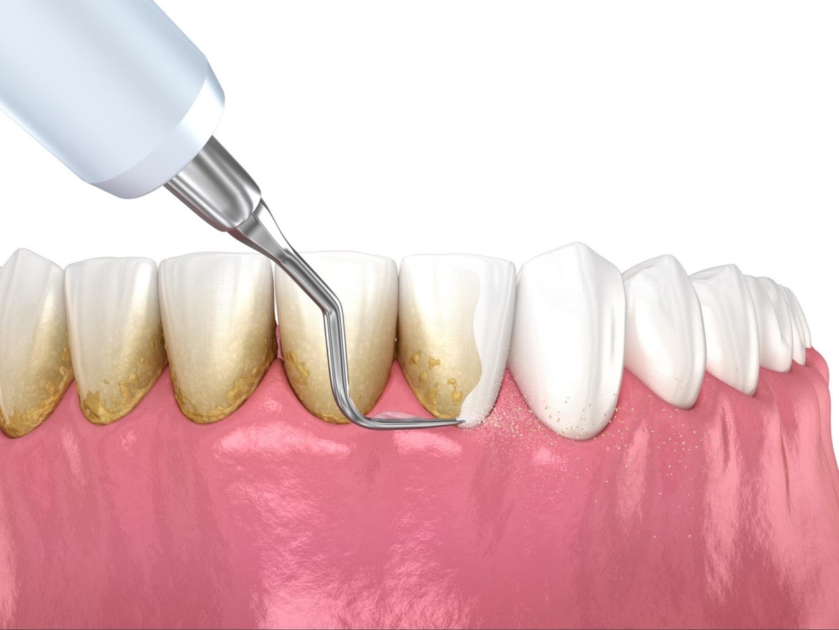 Smyle Dental and Orthodontic Clinic dental clinic