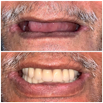 Dental Perk Multispeciality Dental and Implant Centre