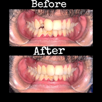 Dental Perk Multispeciality Dental and Implant Centre