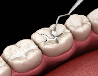 Gratitude Dental Care (Indiranagar) - Dental Clinic