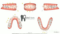 Dental Roots