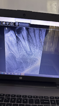Dr Patel Dental Clinic in Bangalore