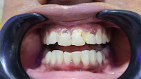 I Smile Dental Care - Multispecialty dental clinic, Orthodontic & Implant Centre - Whitefield ( Dr JayachandraRaj's - br)