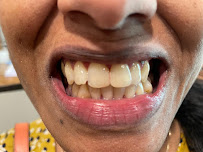 Smile Zone Dental Speciality Centre