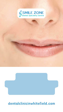 Smile Zone Dental Speciality Centre