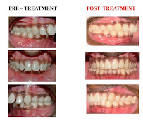 You Smile Dental Clinic/Dentist in Whitefield/Dental Clinic in Whitefield