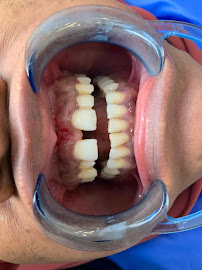You Smile Dental Clinic/Dentist in Whitefield/Dental Clinic in Whitefield