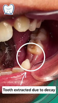 The Smile Clinic | Multispecialty Dental Clinic and Implantology Centre