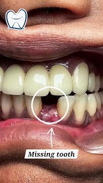 The Smile Clinic | Multispecialty Dental Clinic and Implantology Centre