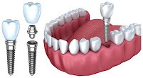 AS Health - Dental clinic in Whitefield | Skin clinic in Whitefield | Hair Clinic in Whitefield