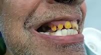 My dental world Whitefield (Dental and physiotherapy clinic)
