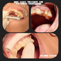 My dental world Whitefield (Dental and physiotherapy clinic)
