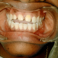 Maruthi Dental Clinic