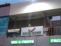 Dental works -Root Canal Specialist, Dental implants and Orthodontic Center Whitefield