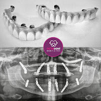 Octodent Dentistry: Best Dental Clinic in Whitefield | Dentist Whitefield | Advanced Dental