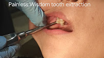 I SMILE DENTAL CARE - Advanced Dental, Root Canal, Implant, Invisalign, Braces, TMJ & Orthodontic Clinic