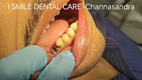 I SMILE DENTAL CARE - Advanced Dental, Root Canal, Implant, Invisalign, Braces, TMJ & Orthodontic Clinic