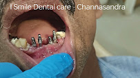 I SMILE DENTAL CARE - Advanced Dental, Root Canal, Implant, Invisalign, Braces, TMJ & Orthodontic Clinic