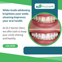 ELV Dental Clinic - Teeth Whitening & Cleaning | Braces | Implants | Invisalign | Root Canal Care in Whitefield, Bangalore
