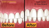 Apple Dental Clinic (#DrVinaySirigere) - Orthodontics | Oral Implants | Oral Rehabilitation | TMJ Spcialist | RootCanalTx |