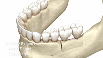 Apple Dental Clinic (#DrVinaySirigere) - Orthodontics | Oral Implants | Oral Rehabilitation | TMJ Spcialist | RootCanalTx |