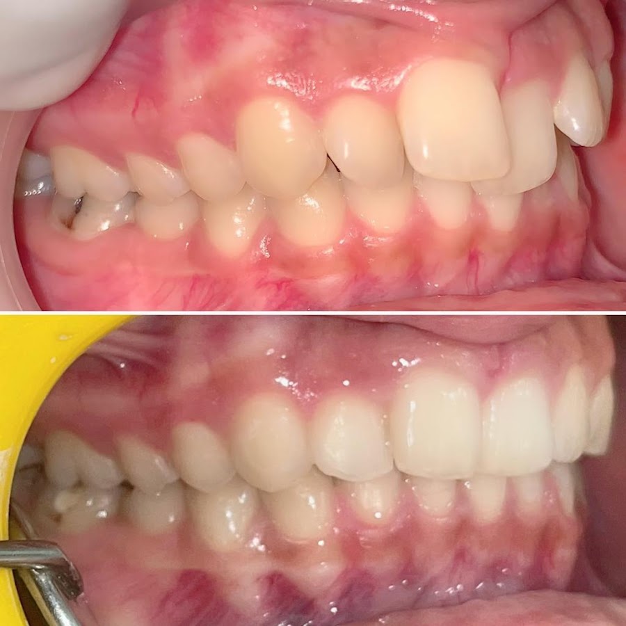 AVMSmiles Dental Clinic dental clinic