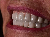 Uma Dental Clinic and Implant Centre