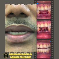 Bangalore Dental & General Polyclinic