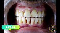 Bangalore Dental & General Polyclinic