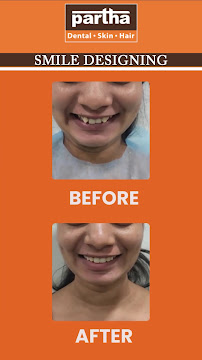 Partha Dental Clinic - Bannerghatta Road Bangalore | Invisalign Provider | Braces, Root Canal & Dental Implants