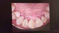 Partha Dental Clinic - Ramamurthy Nagar, Bangalore | Invisalign Provider | Braces, Root Canal & Dental Implants