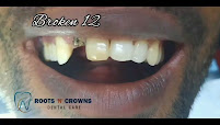Roots N Crowns Dental Care | Dental clinic & Dentist in Anna Nagar | Root Canal doctor Anna Nagar | Dental Surgeon Anna Nagar