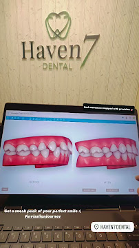 Haven7 Dental Clinic – Anna Nagar, Chennai