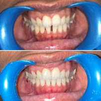 Signature Smilez (Anna Nagar) - Dr Nirmal & Dr Vidhya