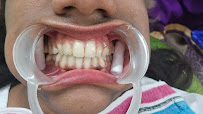 Anna Nagar Dental Clinic