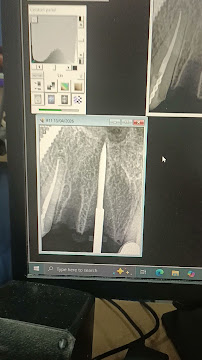 Anbu Laser Dental Clinic