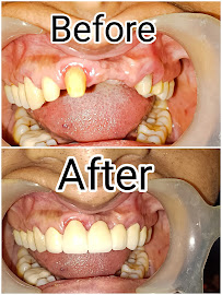 Anbu Laser Dental Clinic