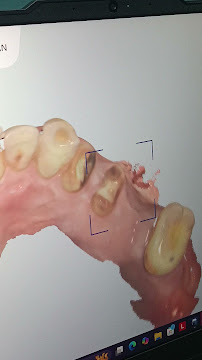 Anbu Laser Dental Clinic