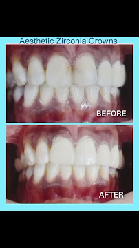 Saratha Dental Foundation | Dental Clinic | Best Implant Centre | Annanagar, Chennai