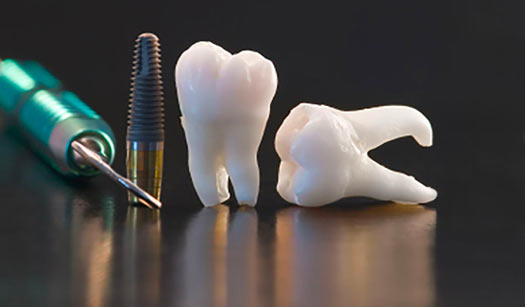 H2 Dental Center dental clinic