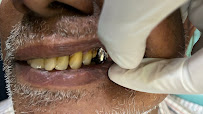 Dr Naga's White Dental Clinic - Implants | Aligners | Root canal treatment