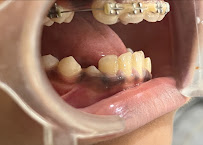 Dr Naga's White Dental Clinic - Implants | Aligners | Root canal treatment